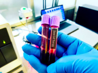 Regena Vida Stem Cell