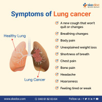 Best Oncologists in Visakhapatnam