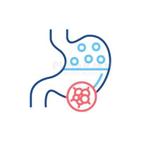 Best stomach Cancer Treatment Hospitals in Hyderabad