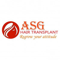 ASG Hair Transplant Centre | Hair Transplant in Punjab