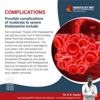CAR T Cell Therapy in Hyderabad: Expert Care by Dr. S.K. Gupta