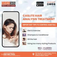 Pulse dye laser treatment in india