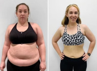 Lifestyle Keto Gummies :- Negative Side Effects or Effective Gummies ?