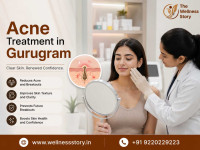 Acne Treatment in Gurugram | Clear & Healthy Skin with Wellness Story