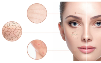 Amarose Skin Tag Remover Reviews