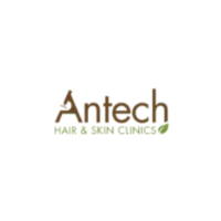 Hair Loss Clinic Toronto | Hair Loss Clinic Near Me | Hair Clinic Toronto