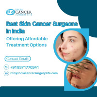 Skin Cancer Treatment in India