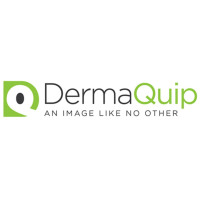 DermaQuip