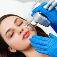 CO2 Laser Scar Treatment