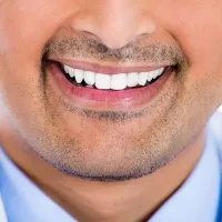 Dental veneers treatment in Islamabad