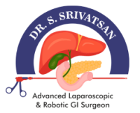Dr. Srivatsan Gurumurthy | Robotic and Laparoscopic Liver and Pancreas surgeon/ Hernia surgeon | Robotic GI Oncosurgeon in Chennai