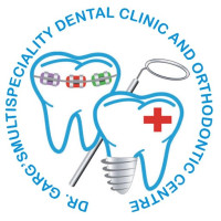Are you searching for Orthodontic Treatment Esthetic Brackets and Lingual Brackets in Meerut? | Dr. Ankit Garg