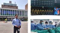 Expert in Angioplasty & Stent Placement – Dr. Ravinder Singh Rao
