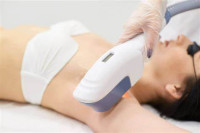 Laser Hair Removal in Islamabad