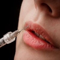 Lip filler in Islamabad