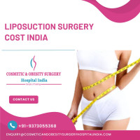 Best Hospitals for Liposuction Surgery India