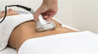 Liposuction in Islamabad