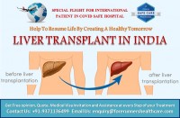Living donor liver transplantation cost in India