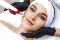 Microneedling Treatment in Islamabad