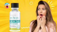 https://www.outlookindia.com/outlook-spotlight/remedy-skin-tag-remover-reviews-fake-or-legit-what-real-customer-say-read-shocking-news-285766