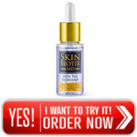 What is SkinBiotix MD Skin Tag Remover?