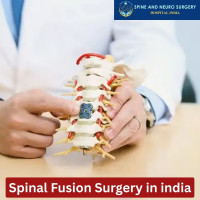 Spine Fusion Surgery Cost in India
