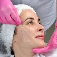 Thread lift Treatment in Islamabad