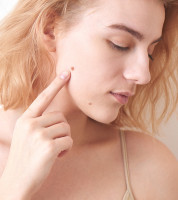 https://silky-skin-tag-remover.hp.peraichi.com/