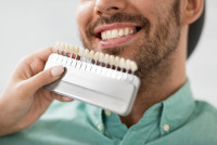 Veneers In Islamabad