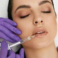Lip augmentation treatment in islamabad pakistan