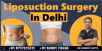 Transform Your Body with Liposuction Surgery in Delhi