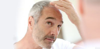 Hair transplant in Guwahati | hairtransplantguwahati.in
