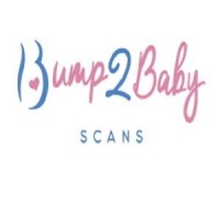 Baby Scan in Leicester | Bump2Baby Scans