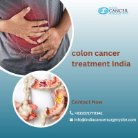Low Cost of Colon Cancer Treatment India