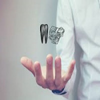 Dental Implants Cost: Dental Implants Prescott AZ