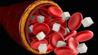 Glucofort Buy Online