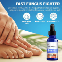 WellaNail Review: Does This Nail Fungus Treatment Really Work?