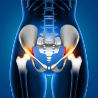Best Hip Replacement Replacement Surgeon in Delhi - Dr. Prof Amit Kumar Agarwal
