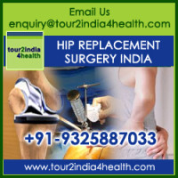 Cost of Hip Replacement Surgery in India