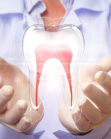 Dental Implants in Islamabad