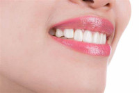 Jaw Surgery in Islamabad