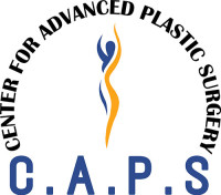 Mastopexy Surgery in Delhi