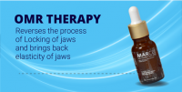 OMR Therapy, Lockjaw Treatment, OSMF treatment