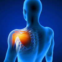 Shoulder Replacement Surgery in India
