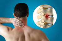 Top spine surgeon in india