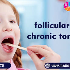Follicular and chronic tonsillitis treatment in Hyderabad