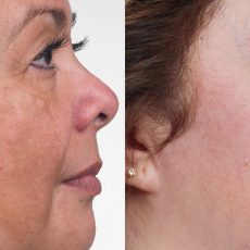 https://healthtalkrev.com/city-beauty-cream/