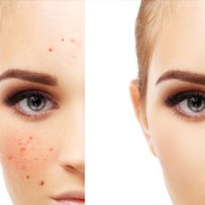 https://healthcounterpro.com/city-beauty-cream/