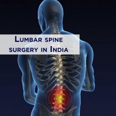 Best Lumbar Spine Specialist in India