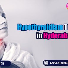 Hypothyroidism Treatment in Hyderabad | Thyroid Treatment